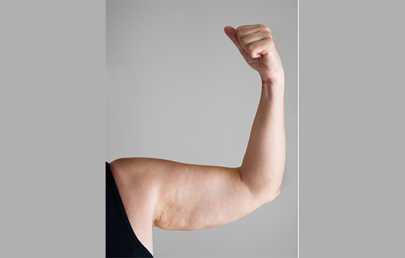 under-arm-fat.