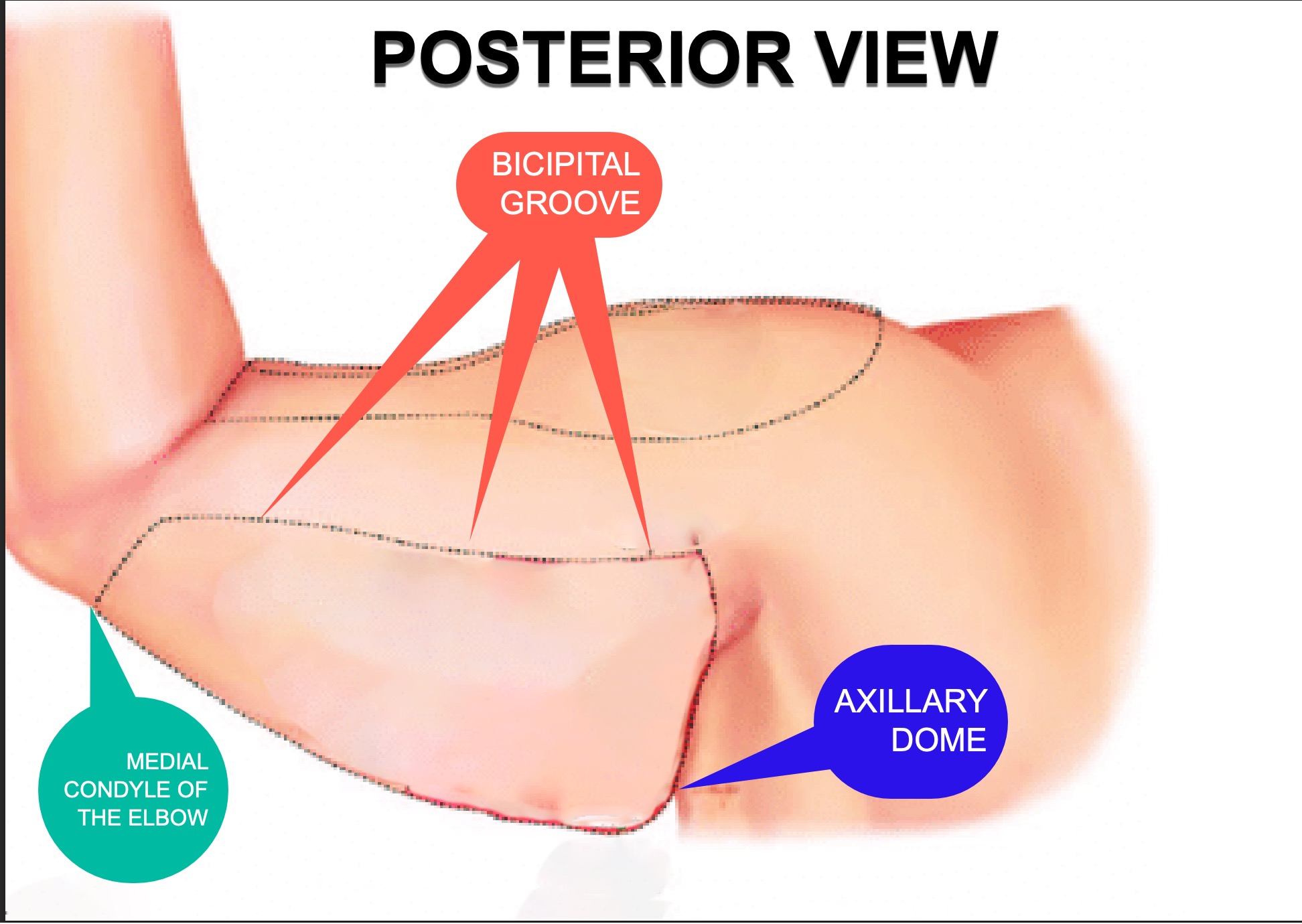 posterior-view-limits-bingo-wings.