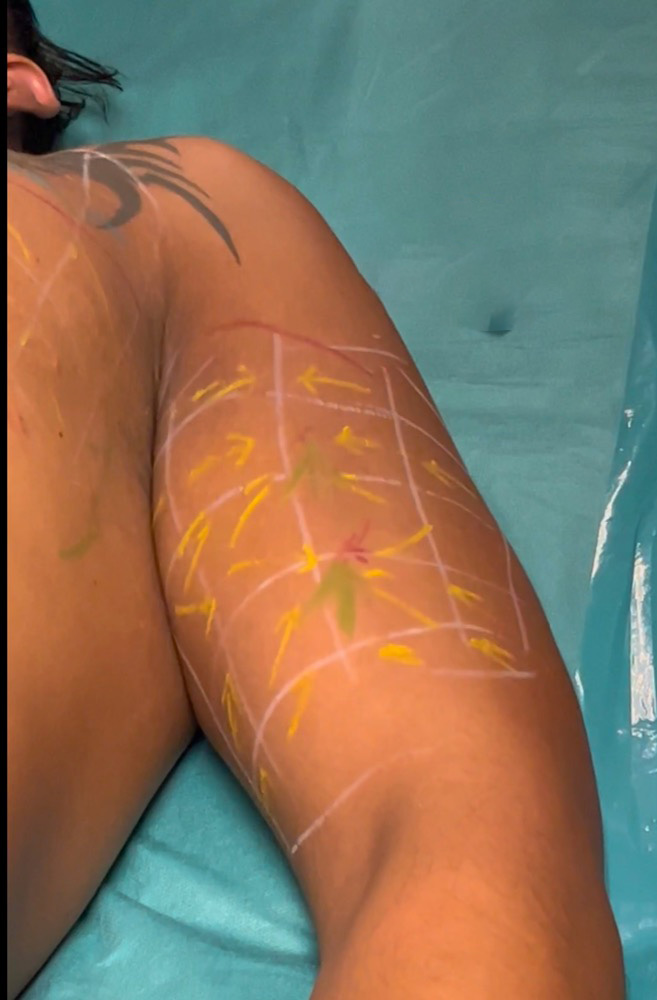 before-desinfection